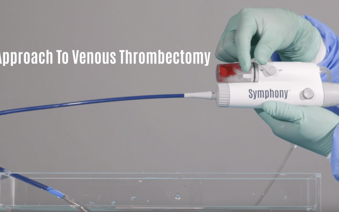 Imperative Care Expands Symphony Precision Thrombectomy Portfolio with Purpose-Built Design for the Treatment of Venous Thrombosis